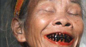 Why do I dream about black teeth? Why do I dream about black teeth?